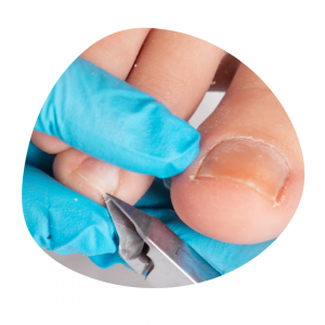 Medisch Pedicurebehandeling Normaal Medisch Pedicurepraktijk Twente