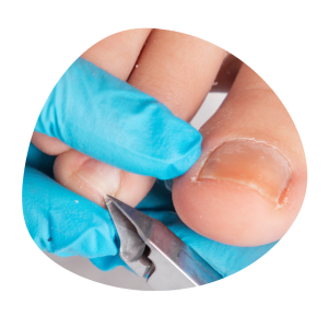 Nagelverzorging medisch pedicure Nagels knippen tijdens een medisch pedicure behandeling
